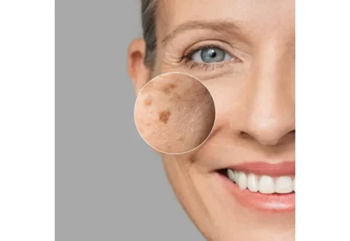 Dark Spot Perfector 30ml - Image 3